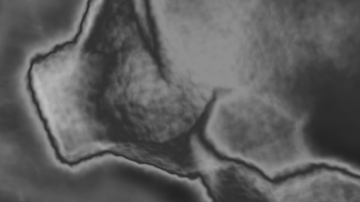 Age-Specific Joint Health: A Decade-by-Decade Guide